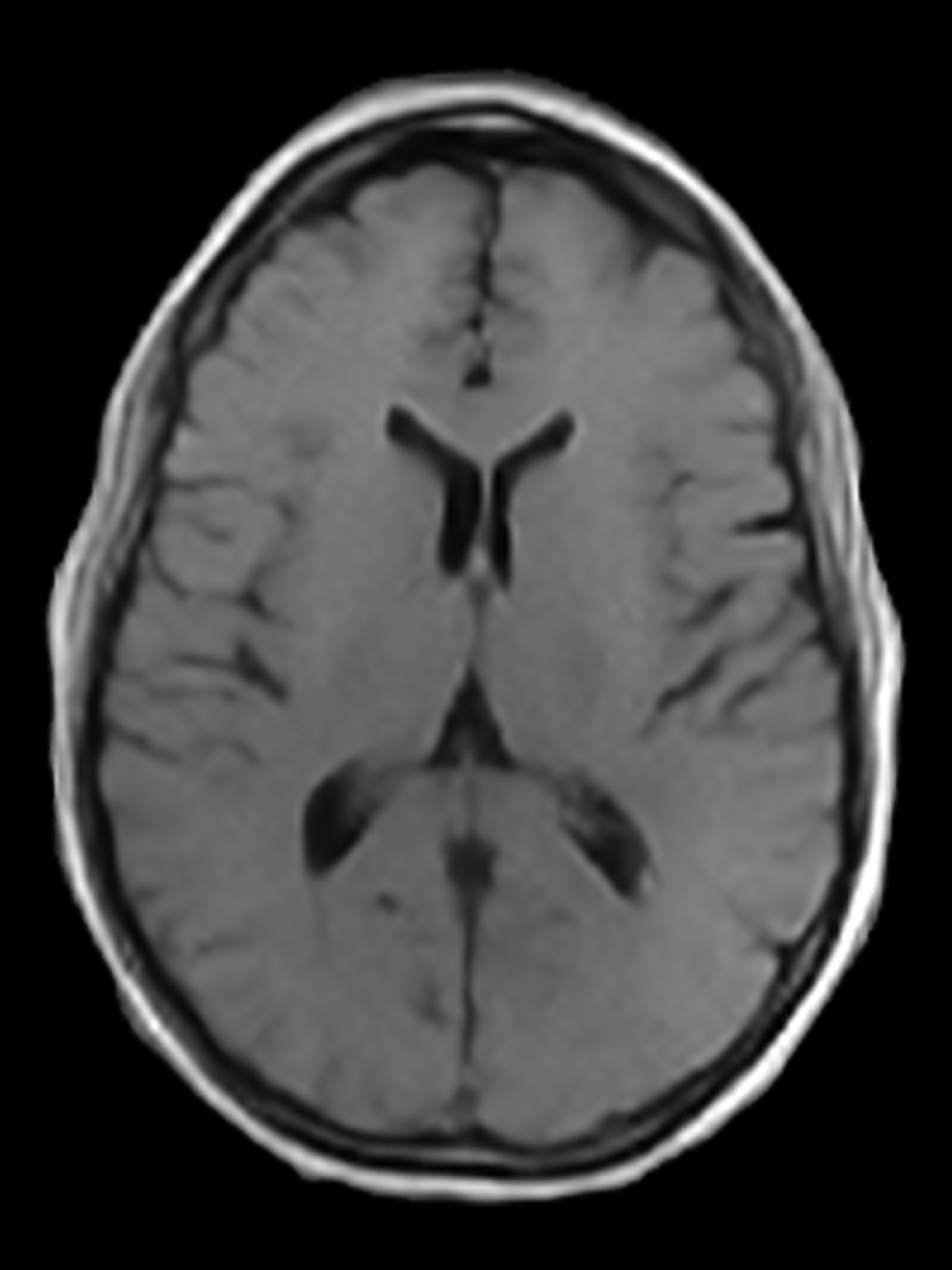 T1 (Standard)