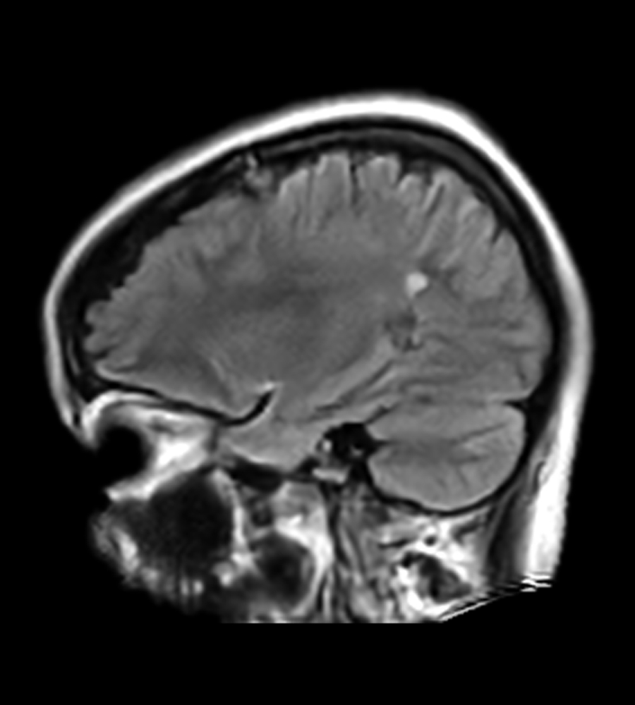 In-house MRI for Neurology Clinics | The Swoop® System