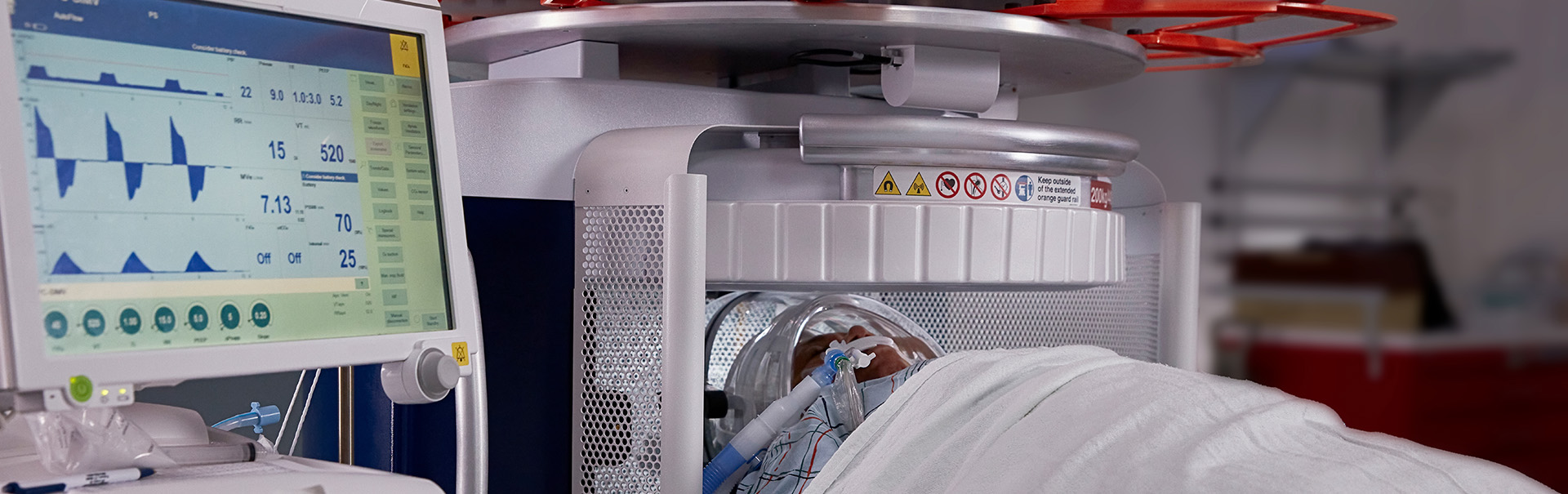 Portable MR Brain Imaging in ICUs
